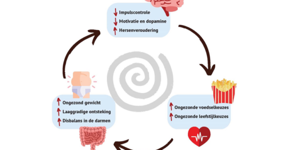 Afbeelding voor Voeding en de hersenen: tweerichtingsverkeer