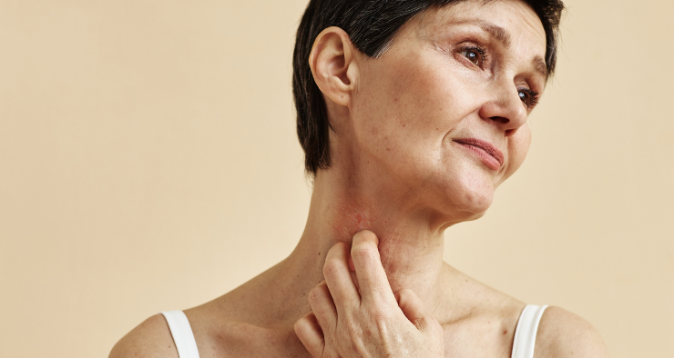 Afbeelding Nieuwe richtlijnmodules huidaandoeningen: psoriasis en constitutioneel eczeem